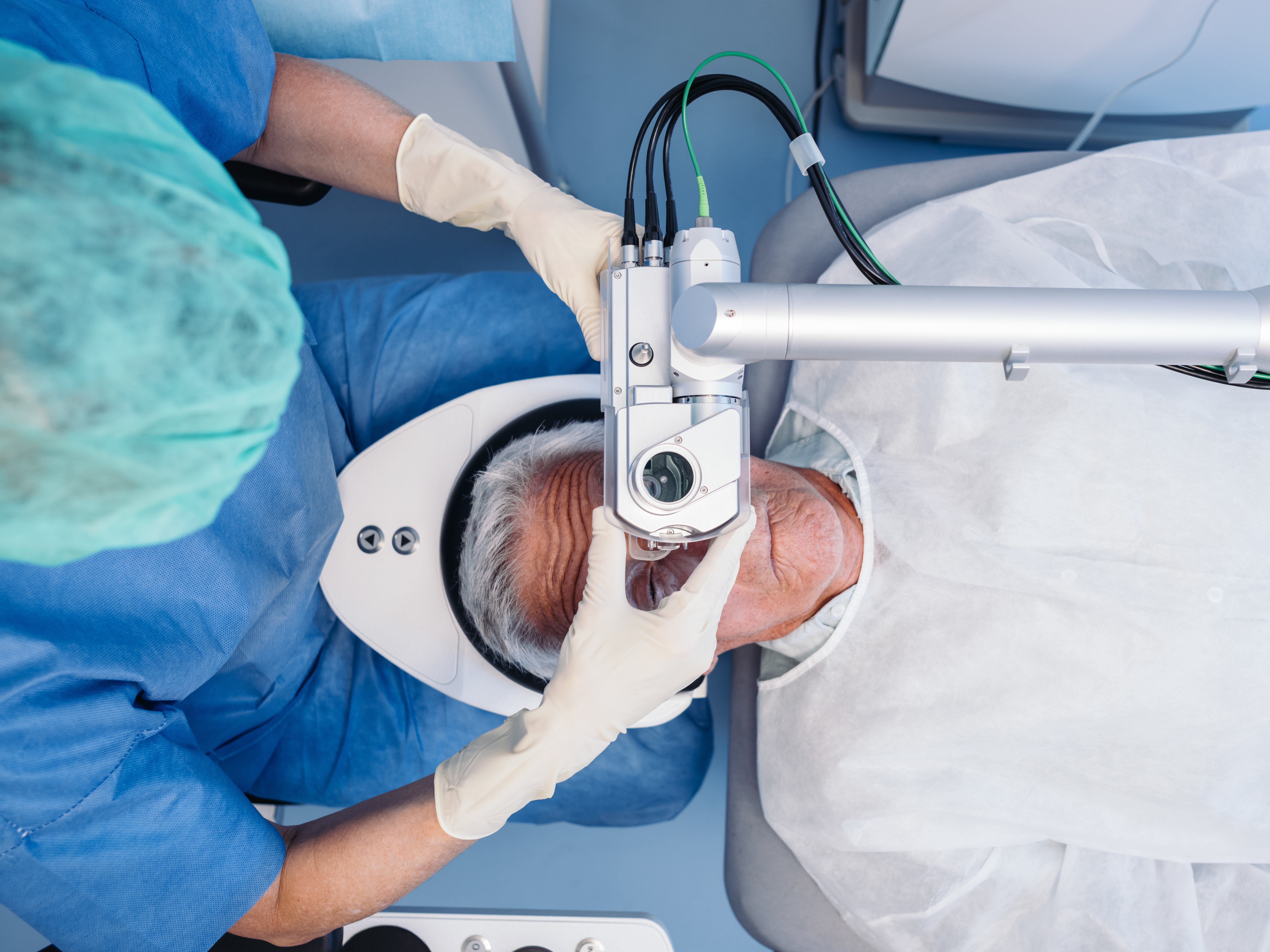 MKL07146_cataract 1